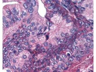 Immunohistochemistry: Apc1 [p Ser377] Antibody [NB600-895]